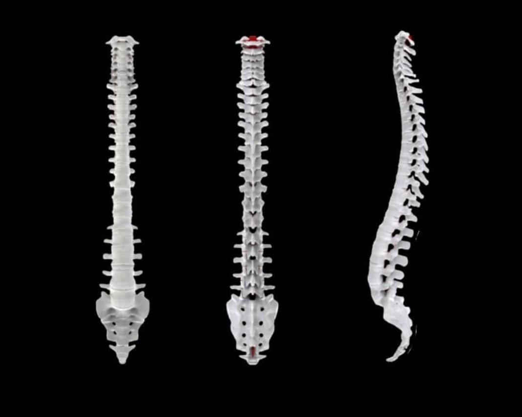 world’s-first-spinal-cord-transplant-in-israel-could-allow-patients-to-walk-again