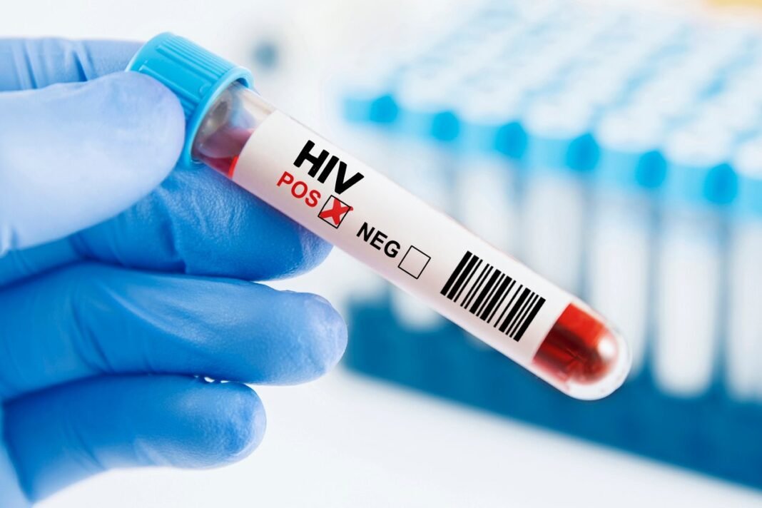 hiv/aids:-Πάνω-από-τις-μισές-διαγνώσεις-στην-Ελλάδα-γίνονται-καθυστερημένα-–-Δράσεις-ελέγχου-από-τον-ΕΟΔΥ