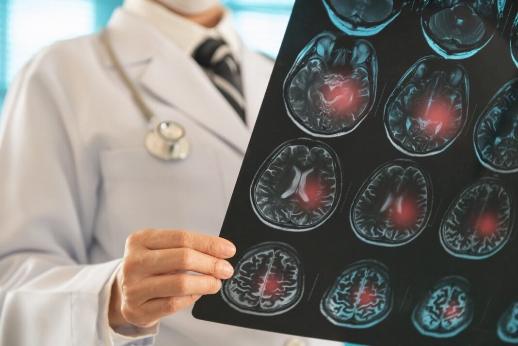 Ασθενείς με εγκεφαλικό ανακτούν την ομιλία τους χάρη σε μια νέα φορητή συσκευή