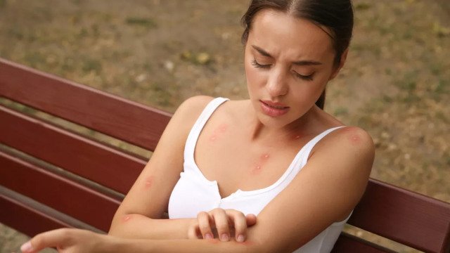 Πώς σχετίζεται η έξαρση του ιού του δυτικού Νείλου στην Αττική με την κακοκαιρία Daniel, εξηγεί ο Γκίκας Μαγιορκίνης Πώς-σχετίζεται-η-έξαρση-του-ιού-του-δυτικού-Νείλου-στην-Αττική-με-την-κακοκαιρία-daniel,-εξηγεί-ο-Γκίκας-Μαγιορκίνης