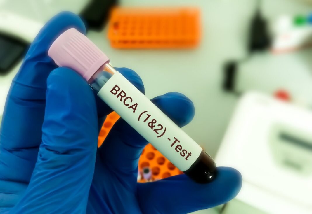 Καρκίνος των ωοθηκών: Πότε πρέπει να γίνεται προληπτική αφαίρεση – Ο ρόλος των γονιδίων BRCA Καρκίνος-των-ωοθηκών:-Πότε-πρέπει-να-γίνεται-προληπτική-αφαίρεση-–-Ο-ρόλος-των-γονιδίων-brca
