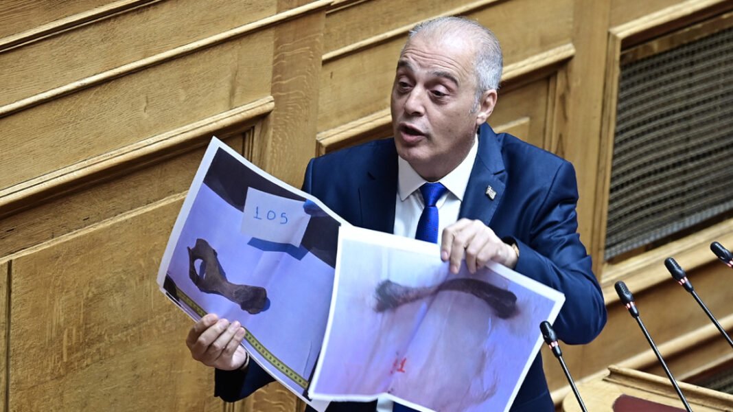 Πλακιάς: Έκπληκτος είδα τον Βελόπουλο να δείχνει φωτογραφίες οστών ζώων στη Βουλή υποστηρίζοντας ότι είναι από θύματα στα Τέμπη Πλακιάς: Έκπληκτος είδα τον Βελόπουλο να δείχνει φωτογραφίες οστών ζώων στη Βουλή υποστηρίζοντας ότι είναι από θύματα στα Τέμπη