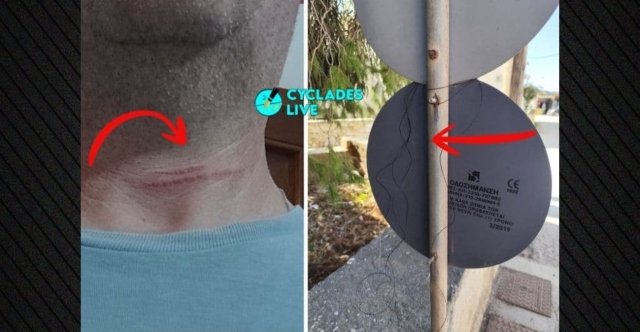 Καταγγελία για παγίδα με πετονιά σε δρόμο της Πάρου: Μοτοσικλετιστής καταγγέλλει ότι τραυματίστηκε στον λαιμό Καταγγελία-για-παγίδα-με-πετονιά-σε-δρόμο-της-Πάρου:-Μοτοσικλετιστής-καταγγέλλει-ότι-τραυματίστηκε-στον-λαιμό